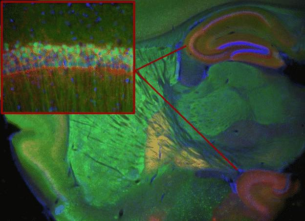 CBD vs THC in a Mouse Brain